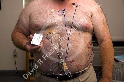 American man wearing a Holter monitor used for monitoring the heart for cardiac arrhythmias. MR